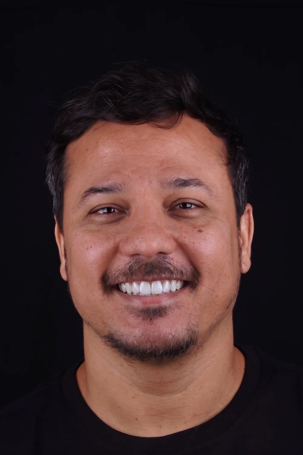 Sorriso depois da simulação de lentes